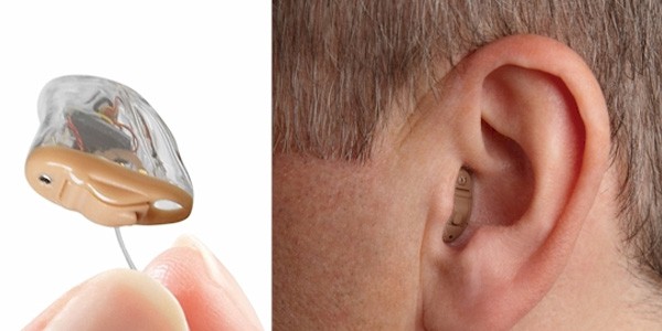 Completely-In-Canal (CIC) Digital Hearing Aid